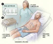 冠心病需要做哪些检查?